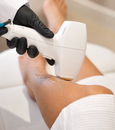 Laser hair removal (1)